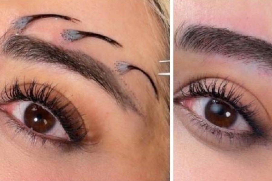 کلینیک پانیکاکاشت تخصصی، ارزان، اقساط مطمئن و خدمات متمایز برای شما